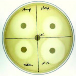 Antibiotic Sensitivity and Bacteria Activity Kit